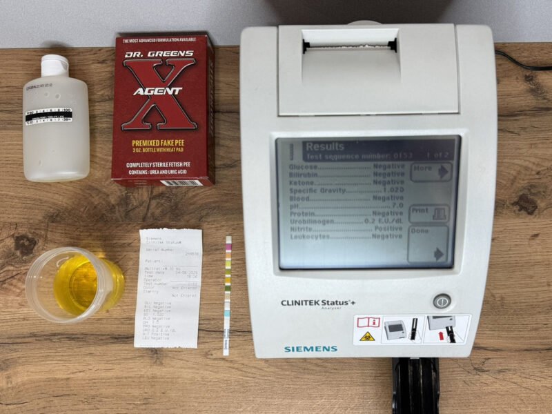 agent x urine lab test