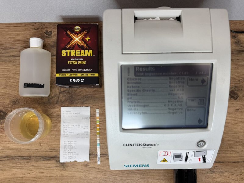 x stream urine lab test